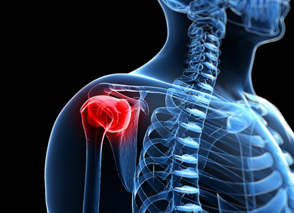 Shoulder