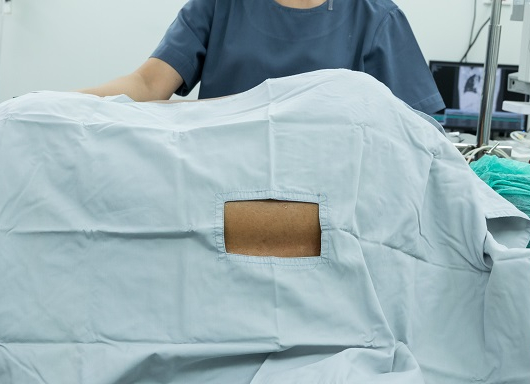 Lumbar Radiculopathy