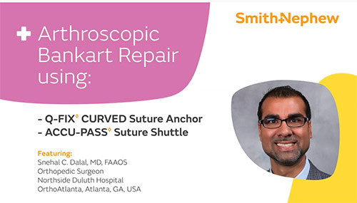 Watch Arthroscopic Bankart Repair with Dr. Snehal Dalal
